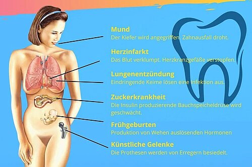 Wie entsteht eine Parodontitis?